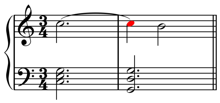 Suspension example