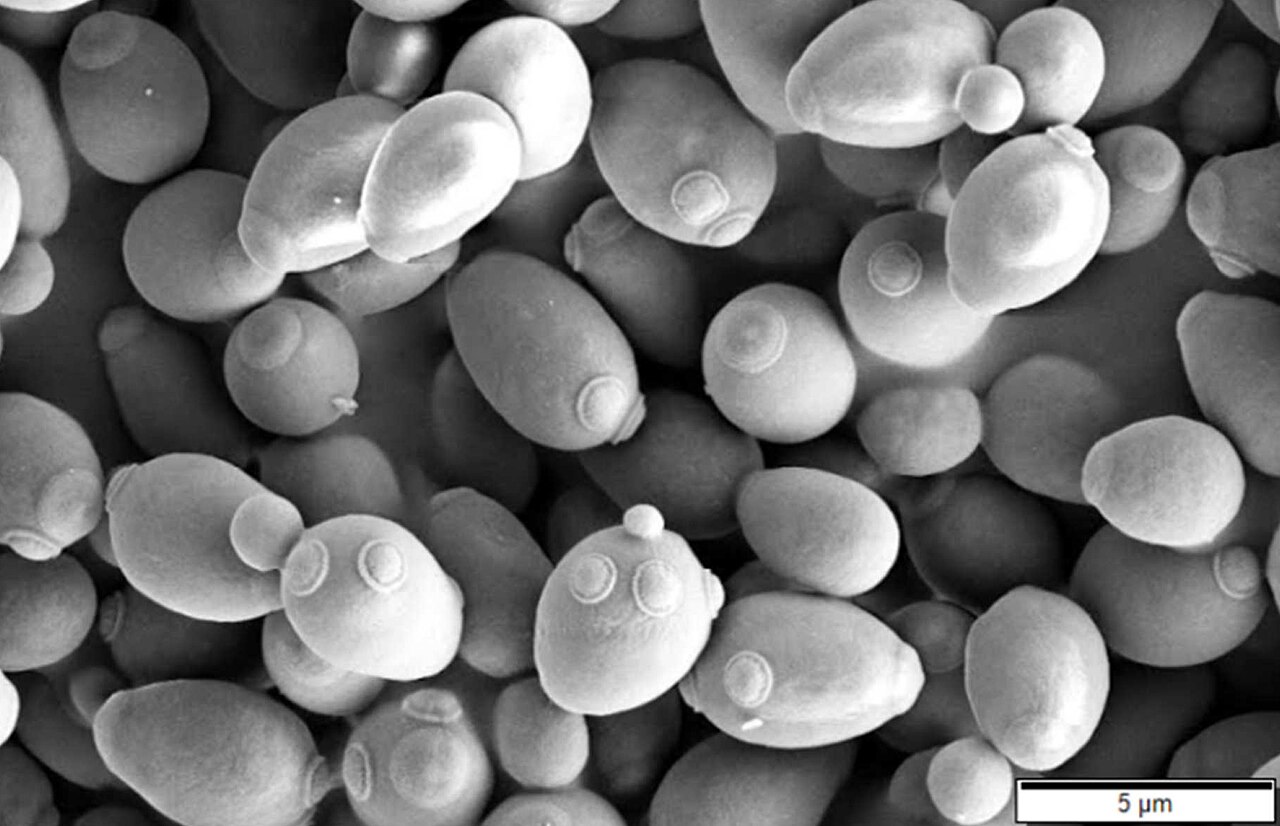Saccharomyces Yeasts