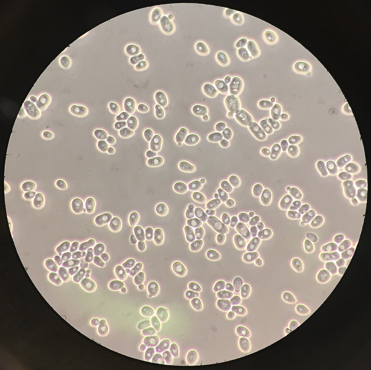 Saccharomyces Yeasts