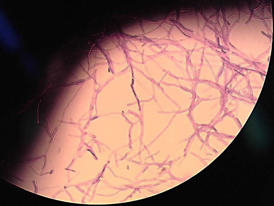 Yarrowia Yeasts