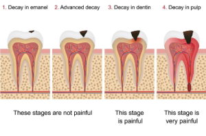 Human Fluoride Needs