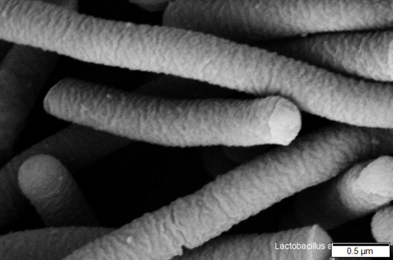 Lactobacillaceae (Lactic Acid Bacteria)