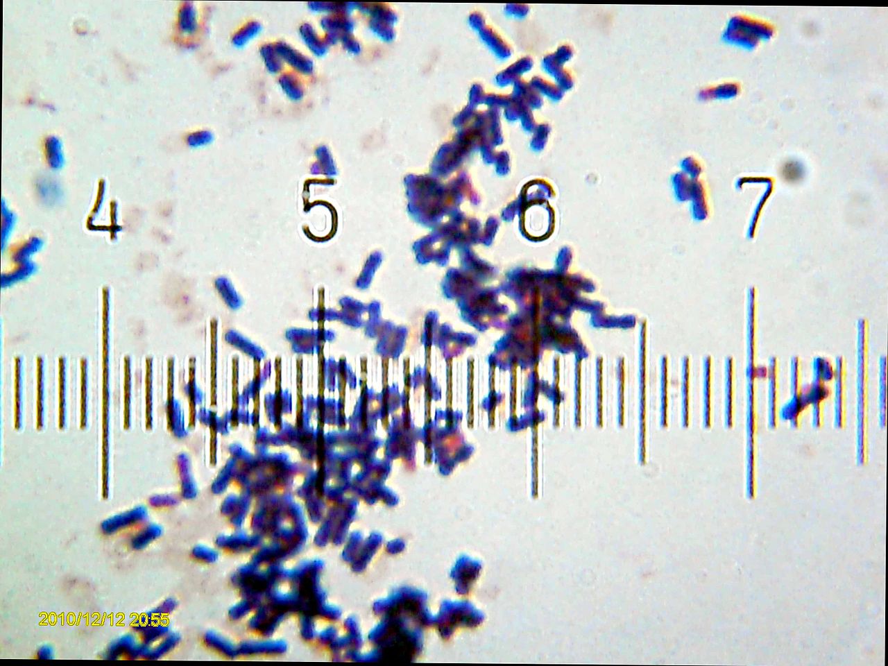 Lactobacillaceae (Lactic Acid Bacteria)