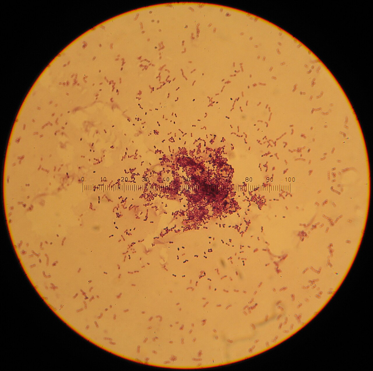 Lactococcus (Dairy Starter Bacteria)