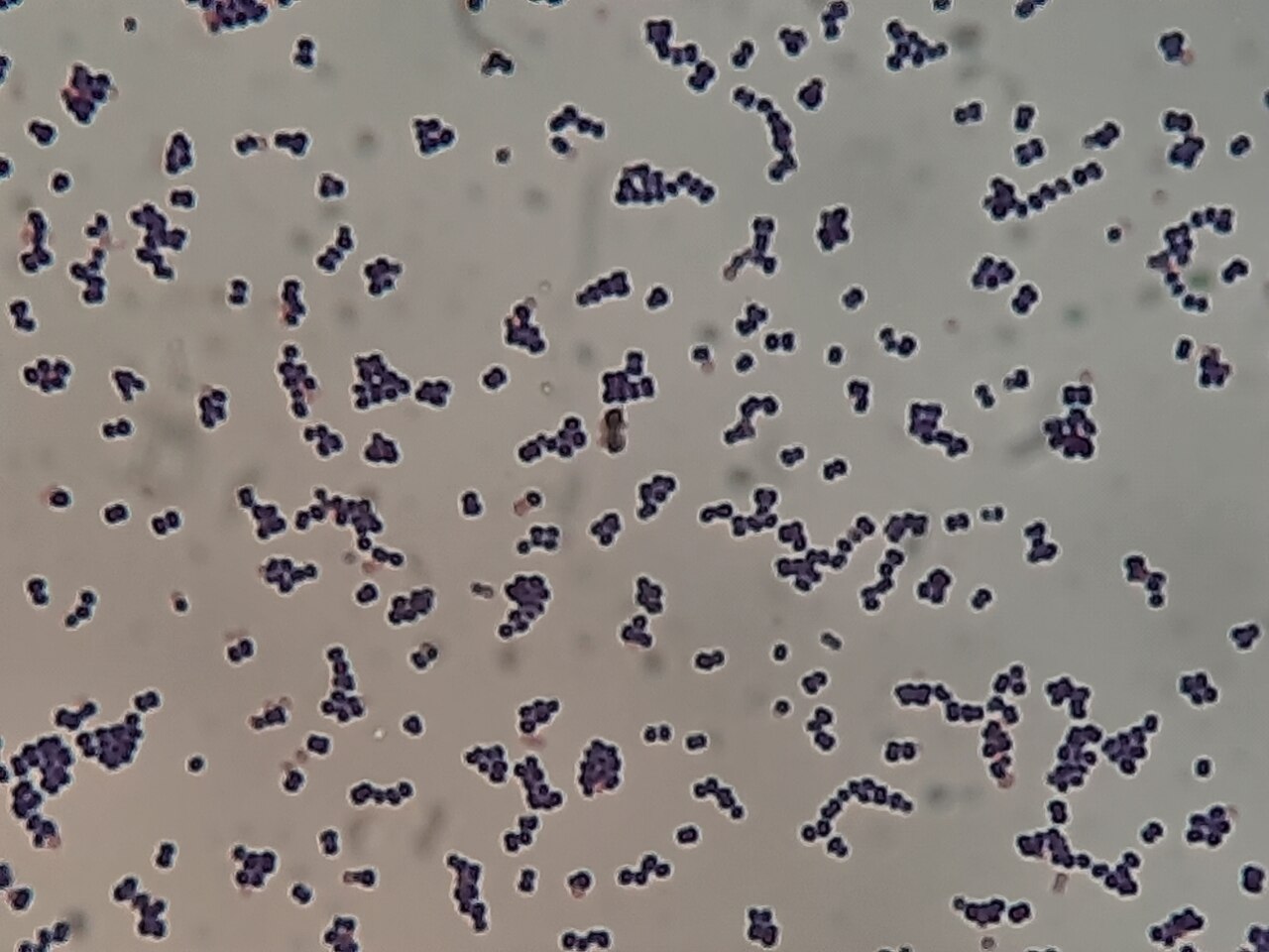 Leuconostoc (Aromatic Fermentation Bacteria)