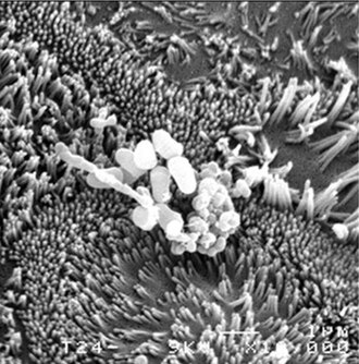 Propionibacterium (Swiss Cheese Bacteria)