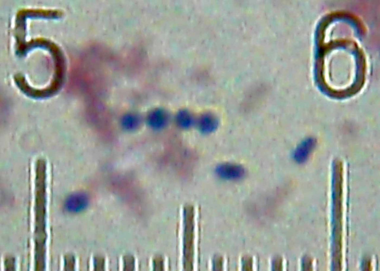 Streptococcus (Yogurt Bacteria)