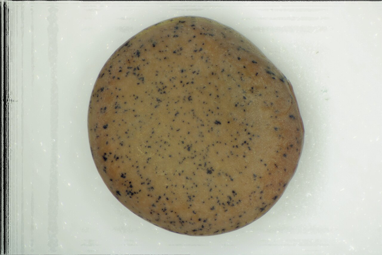 Lentil